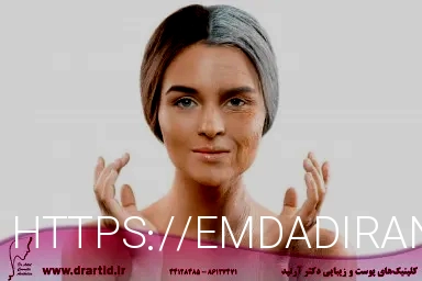 آر اف بهتر است یا هایفو